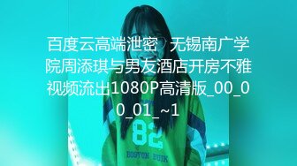 Al&mdash;IU 身体检查